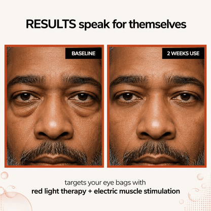 Peptina® 2-in-1 Red Light Therapy + EMS To Erase Eye Bags