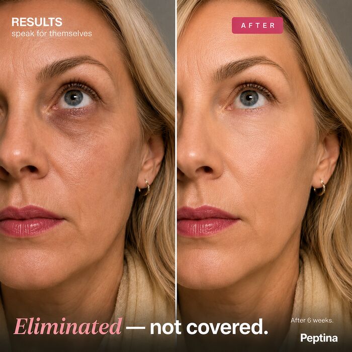 Before and after results