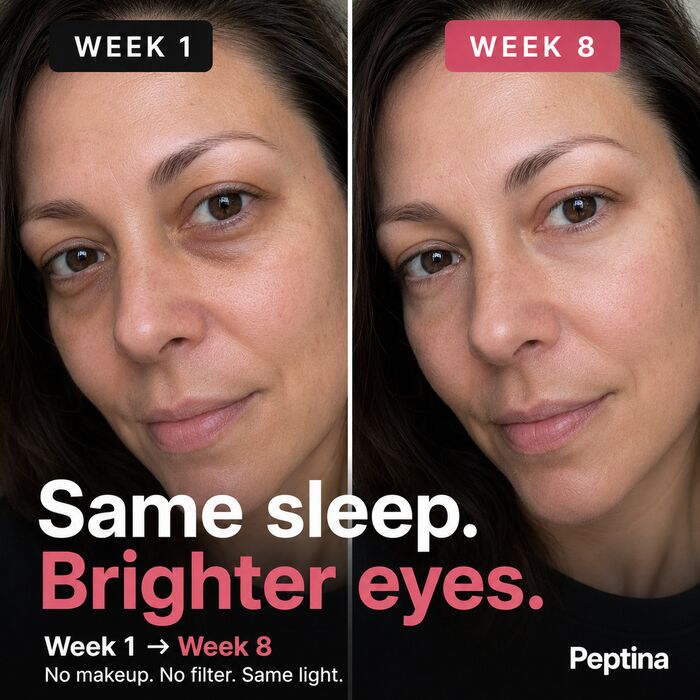 Before and after results