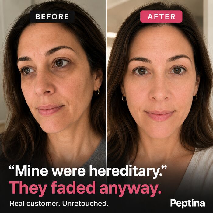 Before and after results