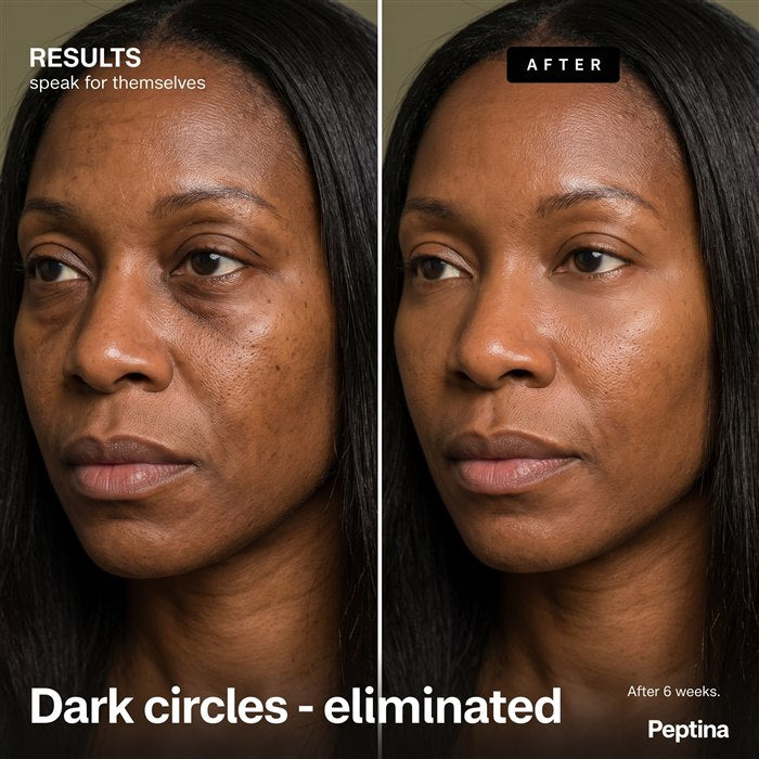 Before/After