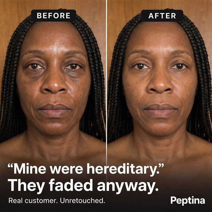 Before/After