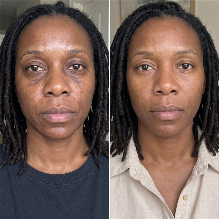 Simone before/after