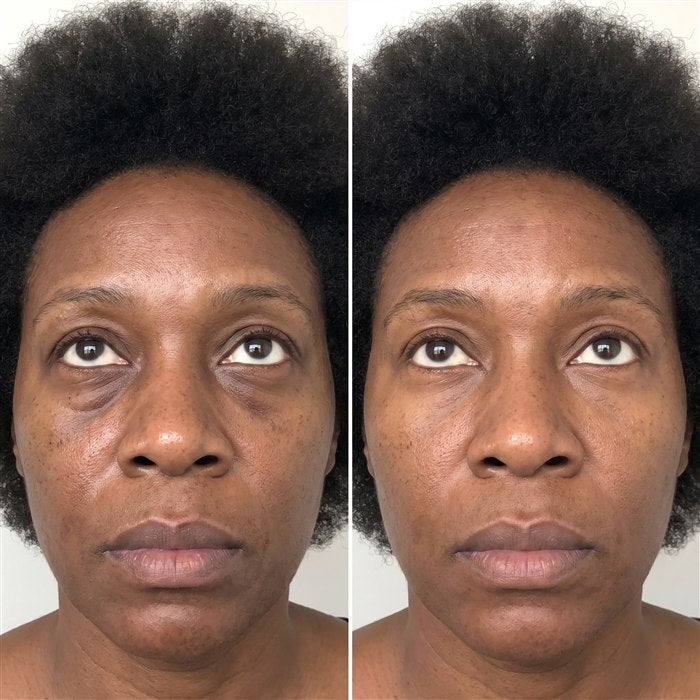 Imani before/after