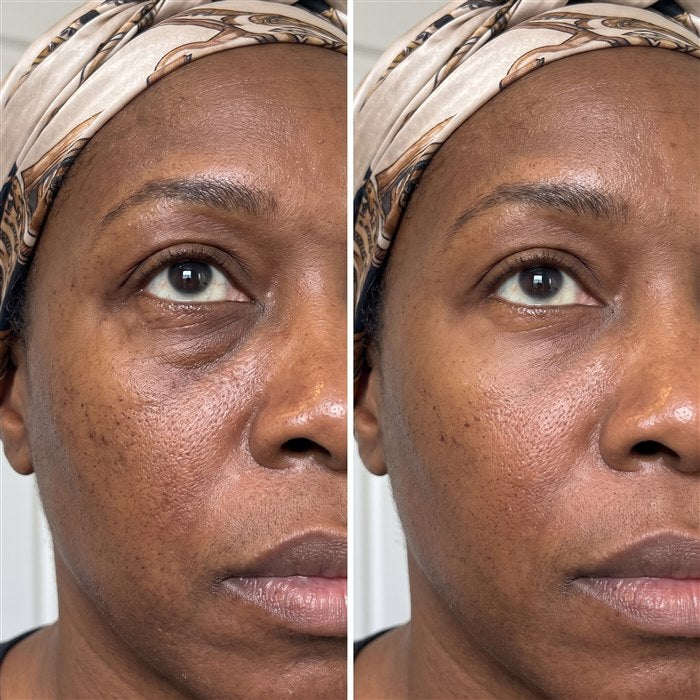 Yvonne before/after