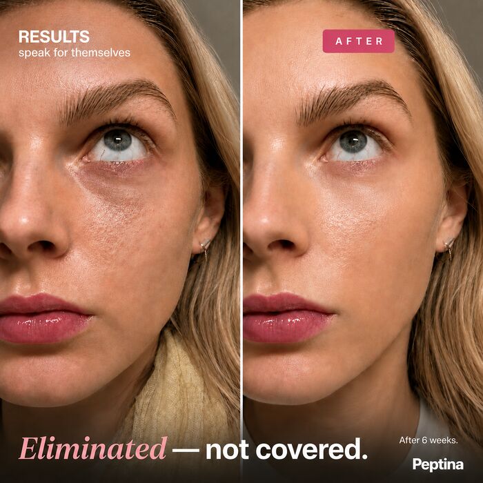 Before and after results