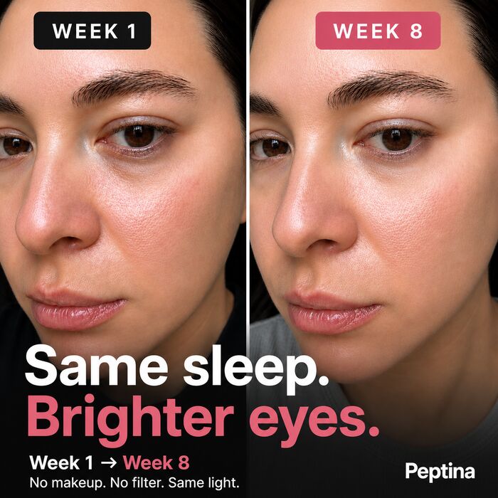 Before and after results
