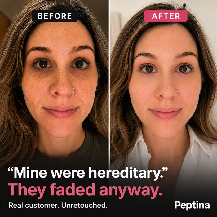 Before and after results