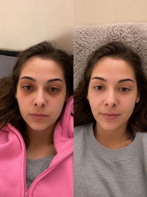 Before and after