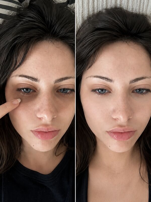 Before and after