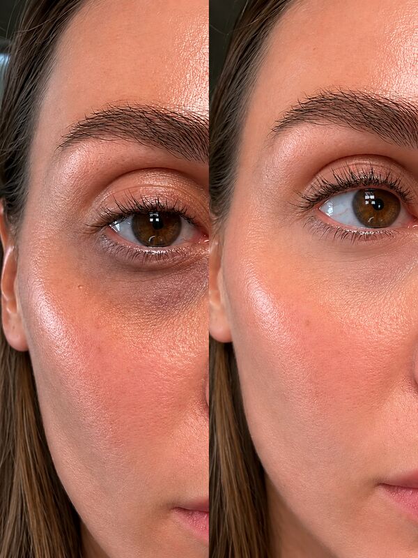 Before and after
